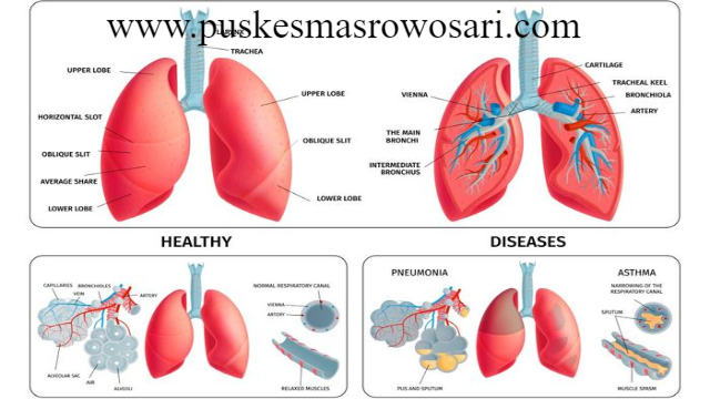 3 Cara Menjaga Kesehatan Organ Pernapasan